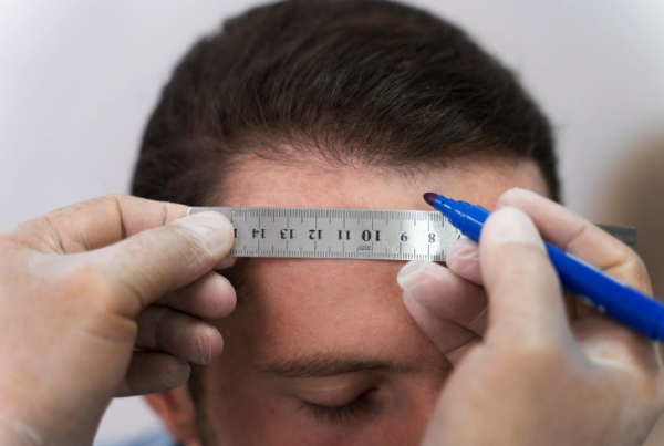 sac-ekim-fiyatları-2025