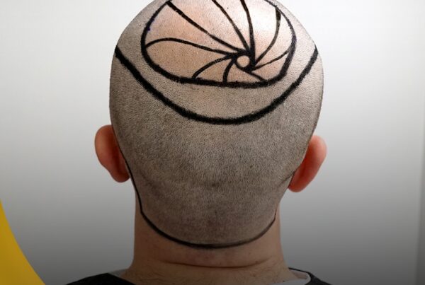 vartex-sac-ekimi-cizim